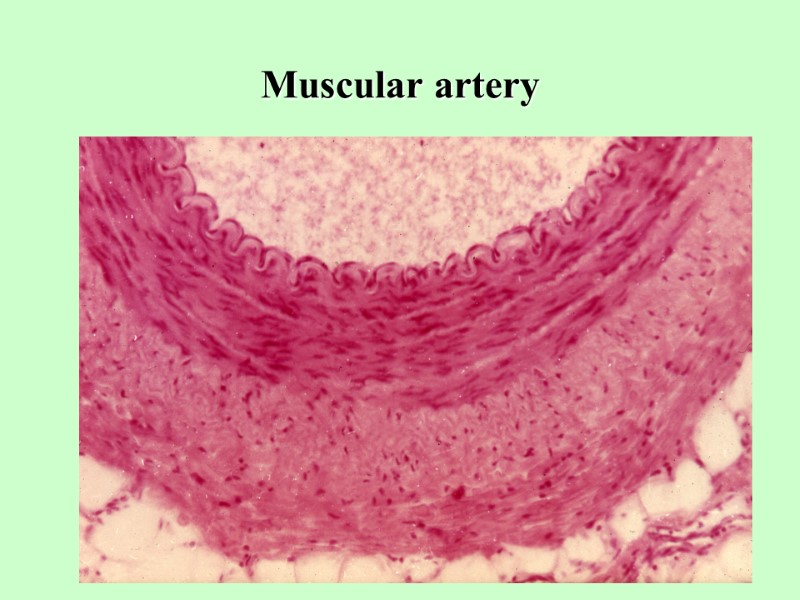 Muscular artery